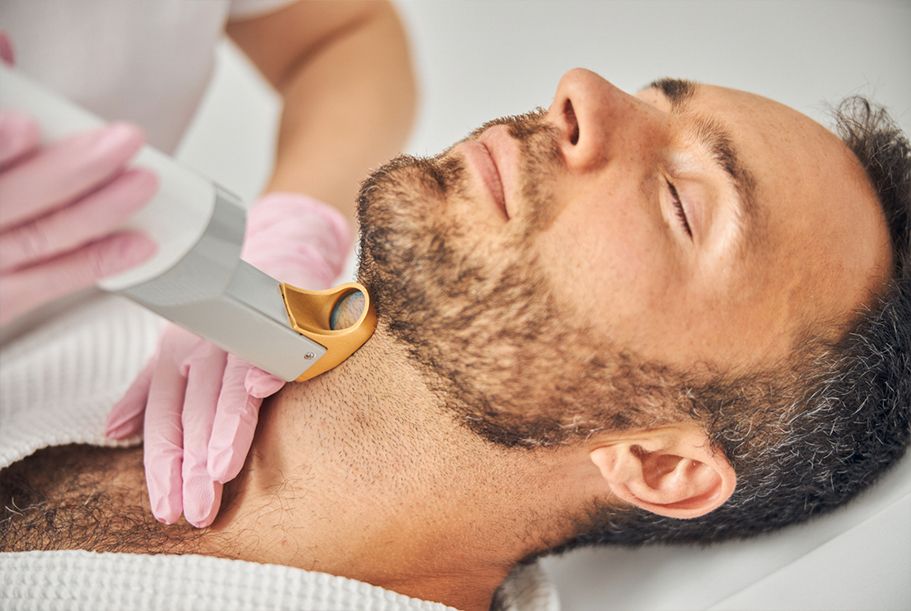 Comprehensive Guide to Facial Hair Laser Treatment