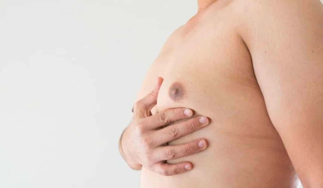 Exploring Fat Freezing Man Boobs: A Comprehensive Guide