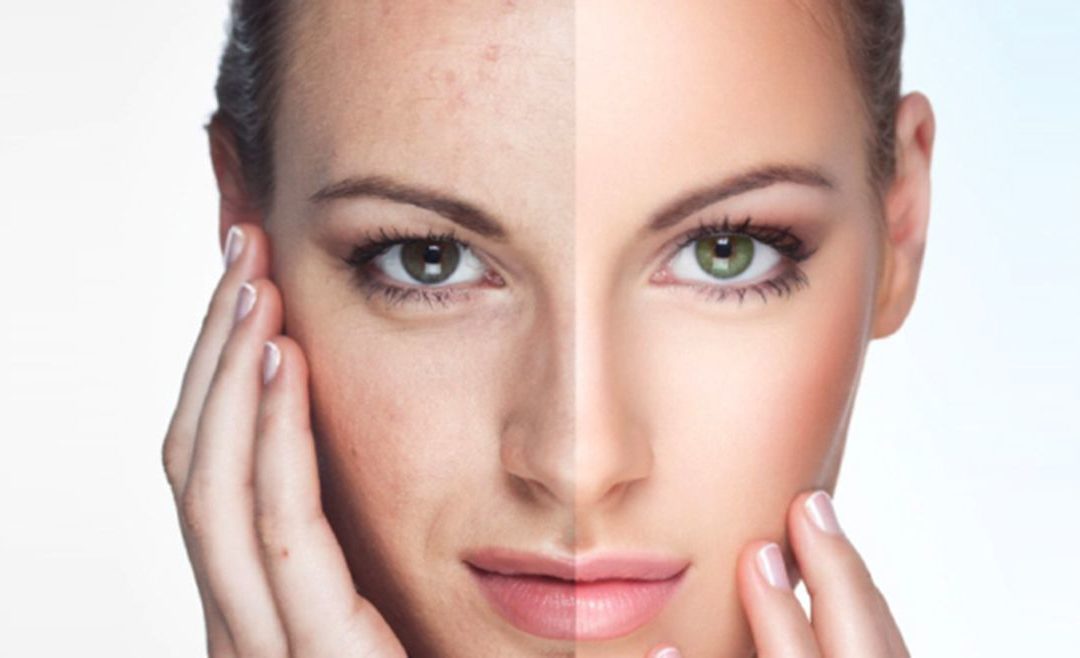 Ultimate Guide to Facial Rejuvenation