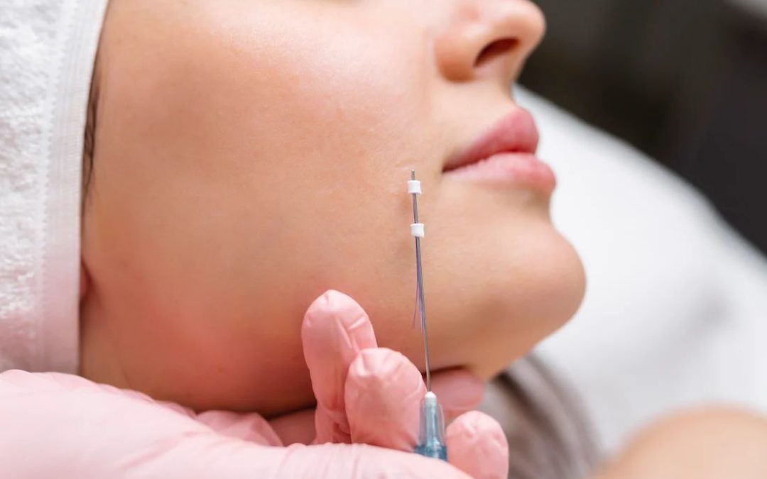 Exploring Collagen Threads: A Comprehensive Guide