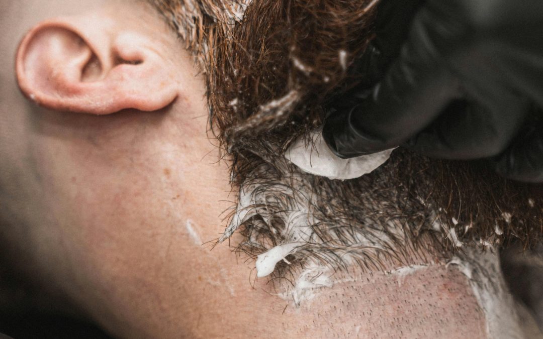 Comprehensive Guide to Laser Beard Removal for Men