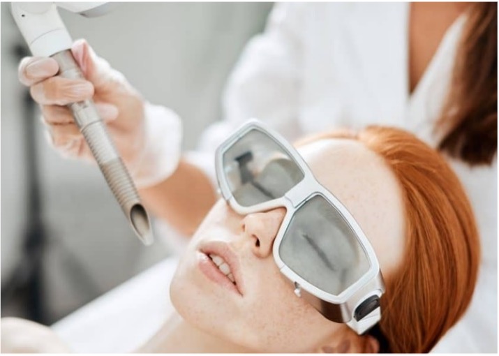 Facelift mit Laser