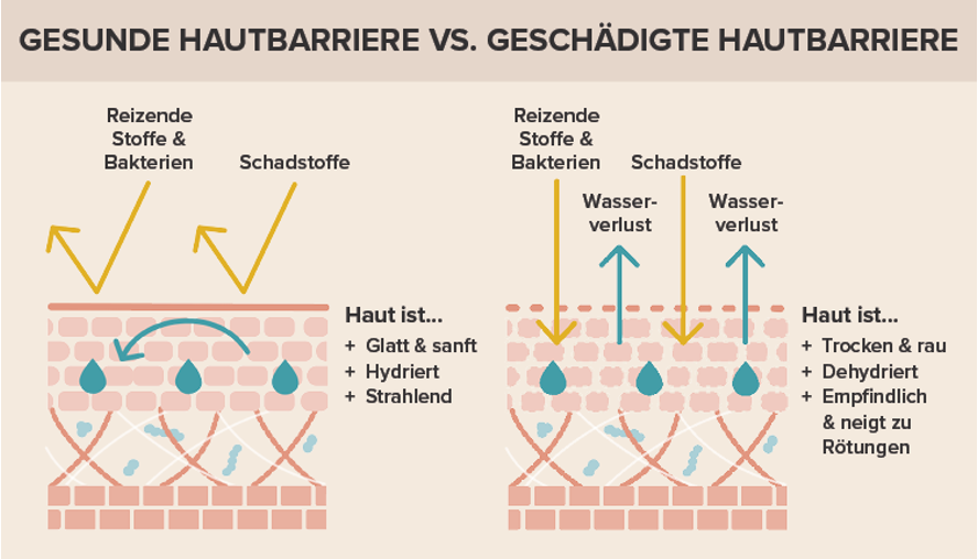 Hautbarriere