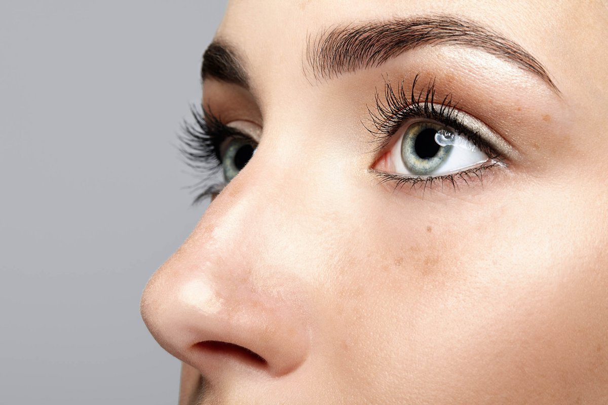 Augenbrauenlifting – Brow Lift