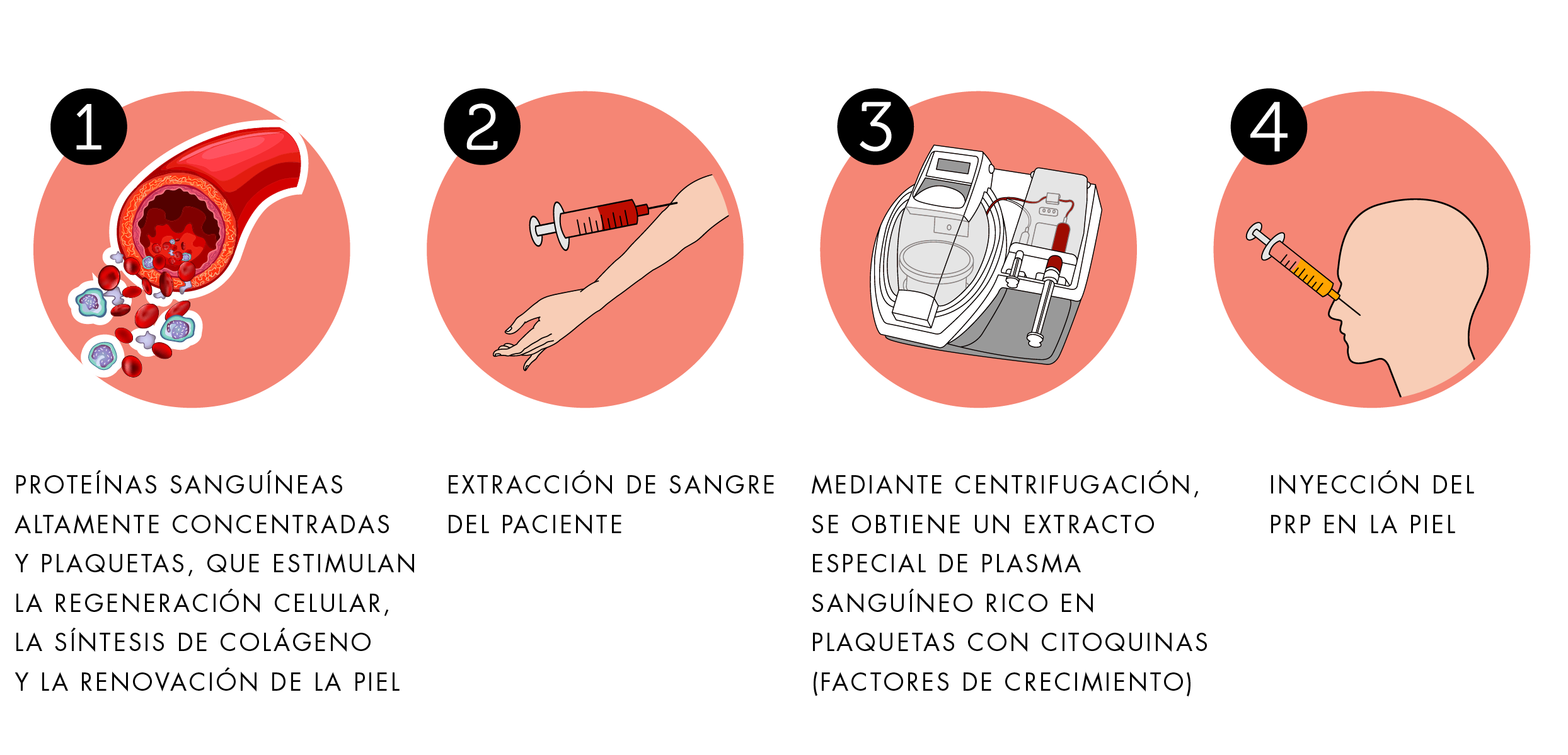 Terapia con sangre autóloga en Suiza
