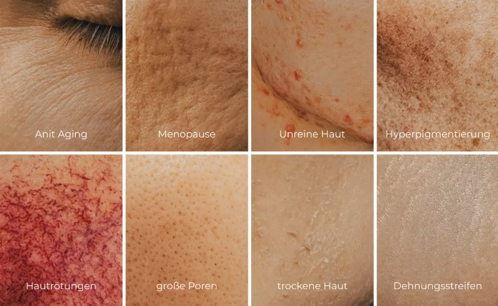 Futuracontour Anwendung