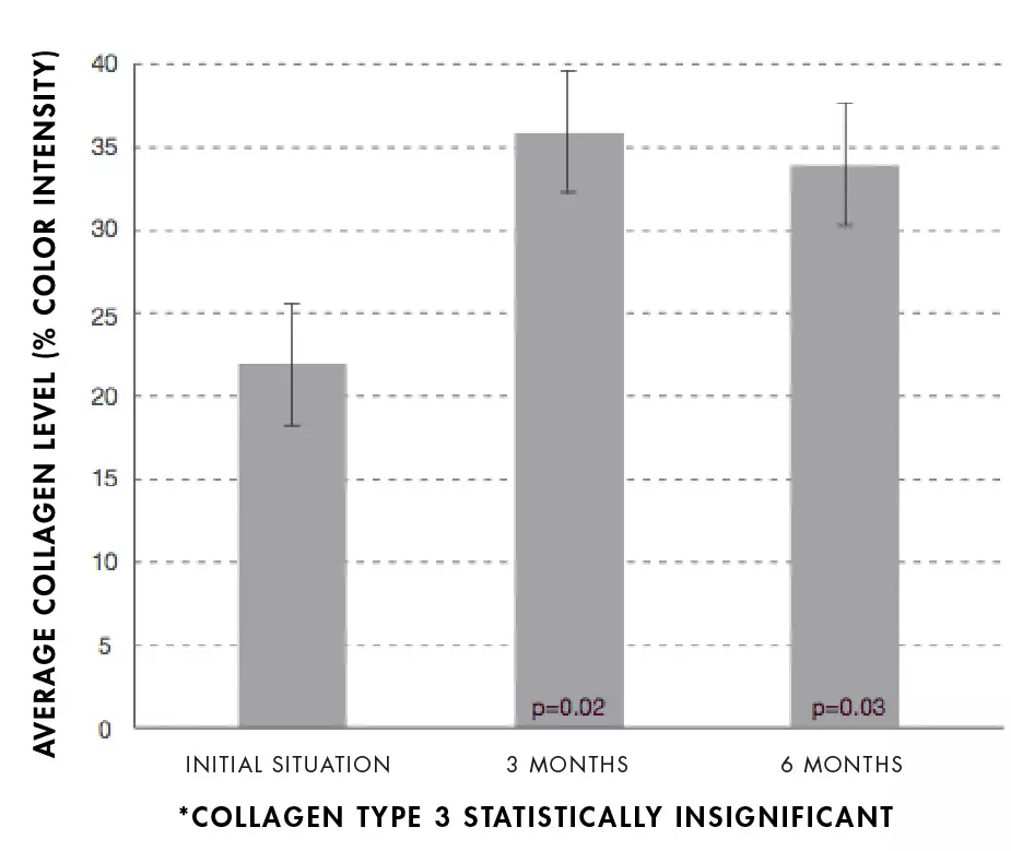 Increase collagen Sculptra