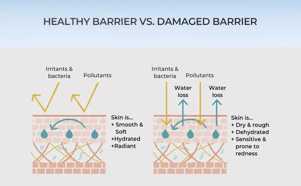 Skin barrier