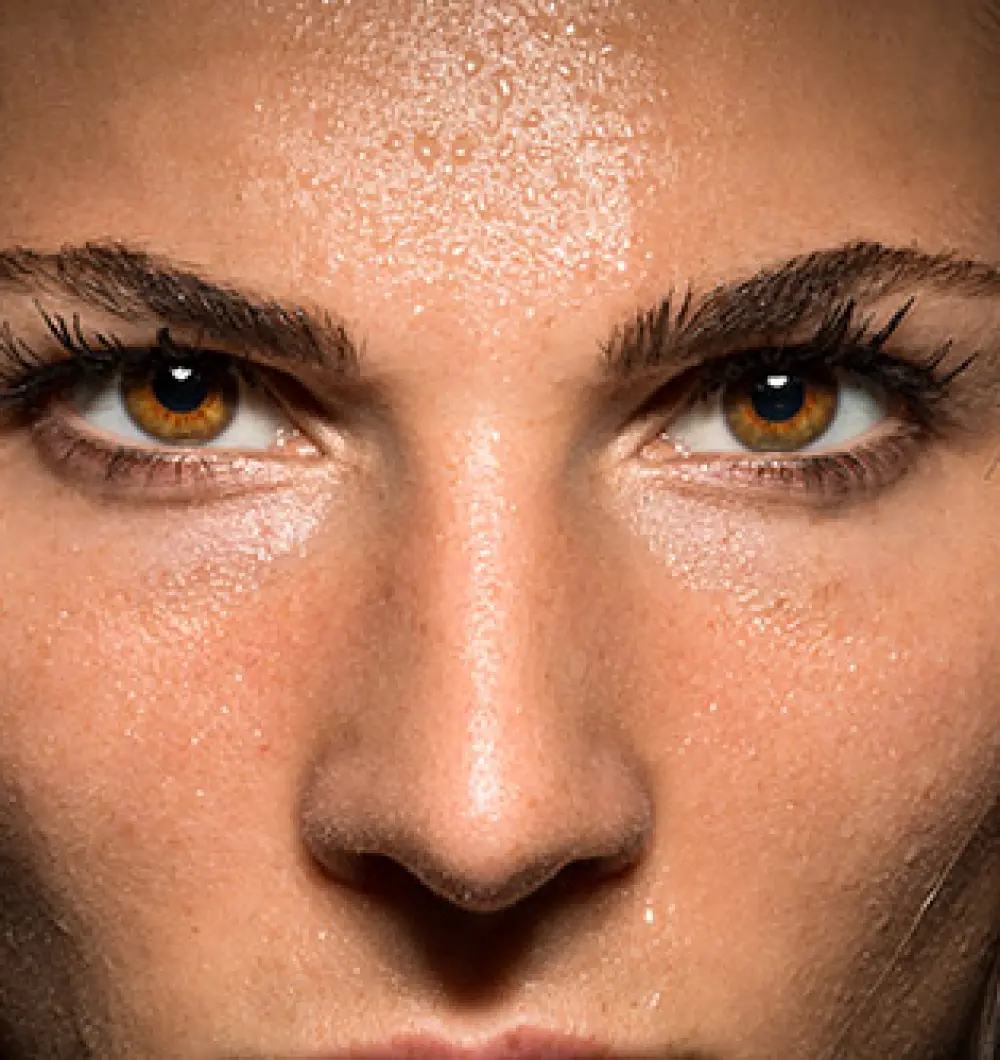 Excessive sweating