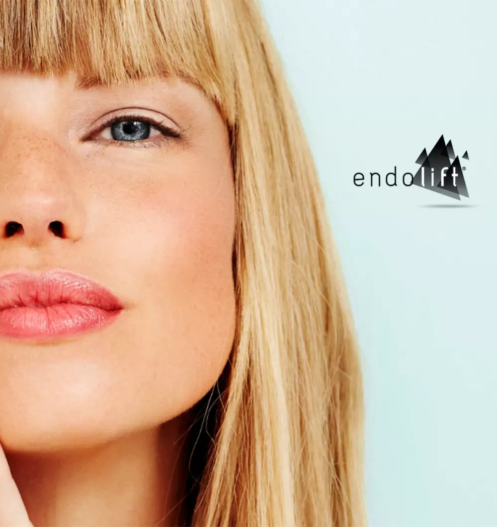Endolift<sup>®</sup>