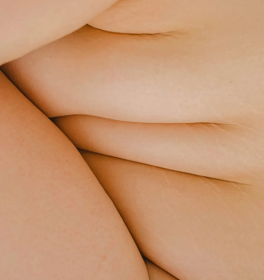 Fat removal