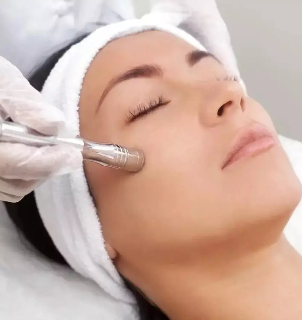 Microdermabrasion