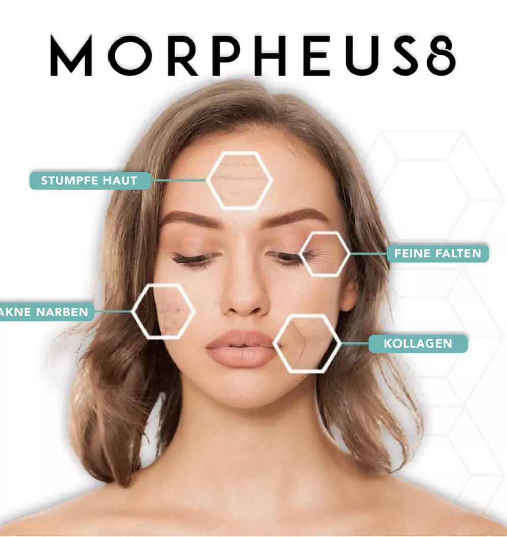 Morpheus 8