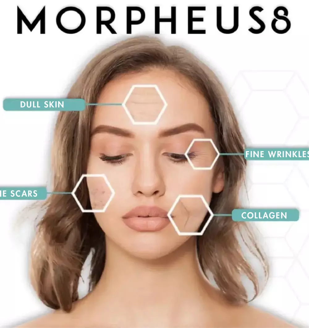 Morpheus8