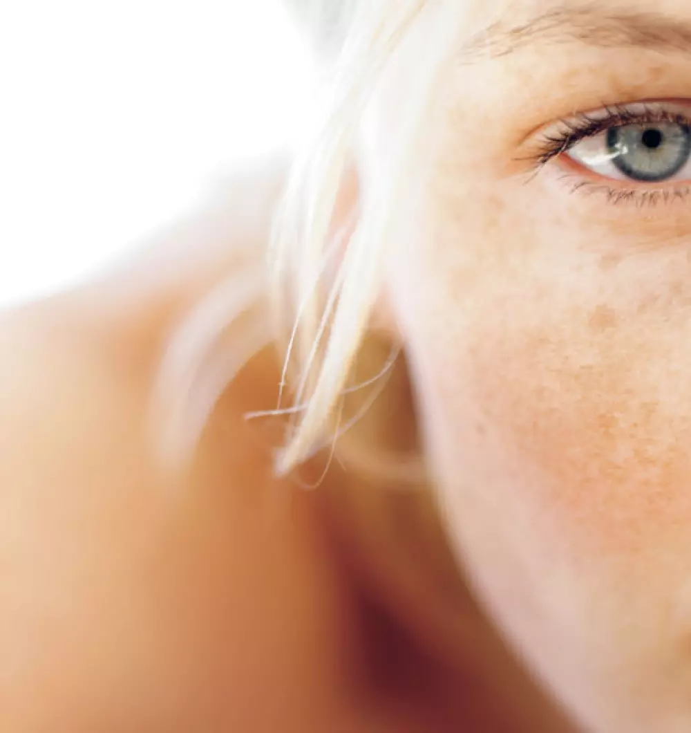 Remove pigment spots