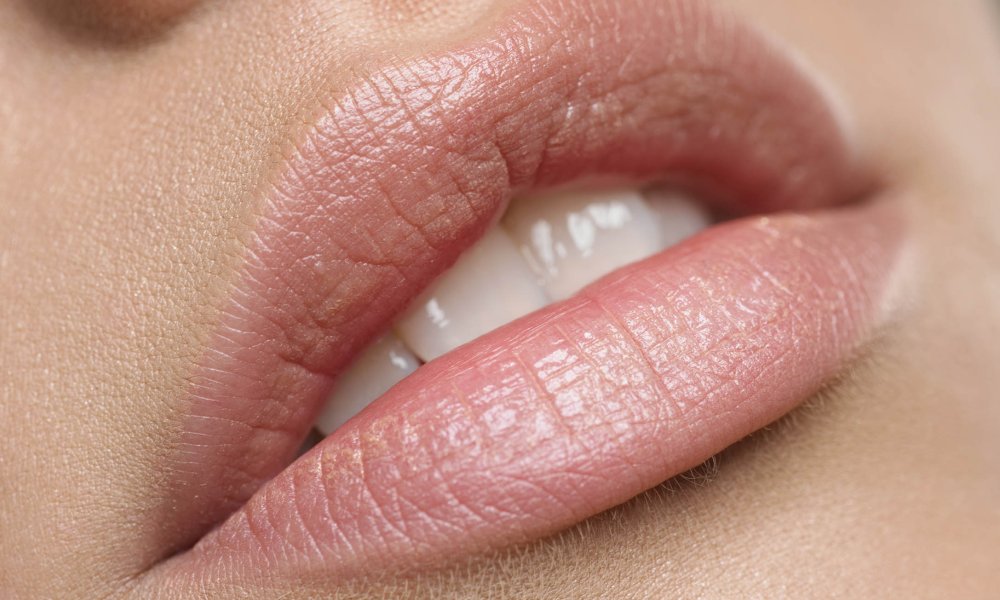 Lips | BEAUTYCLINIC