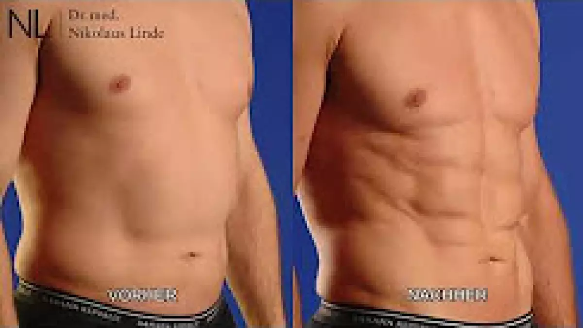 Sixpack