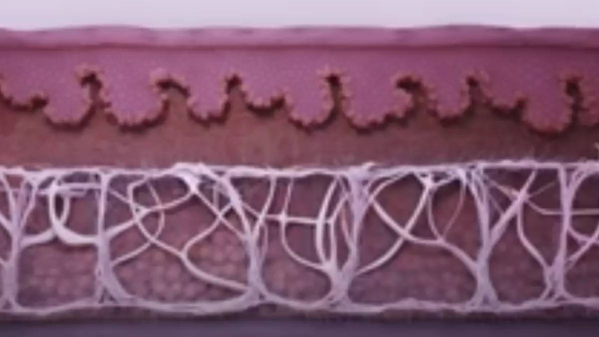 Dr. Linde - <sup>Ultherapy®</sup> - Skin tightening without surgery