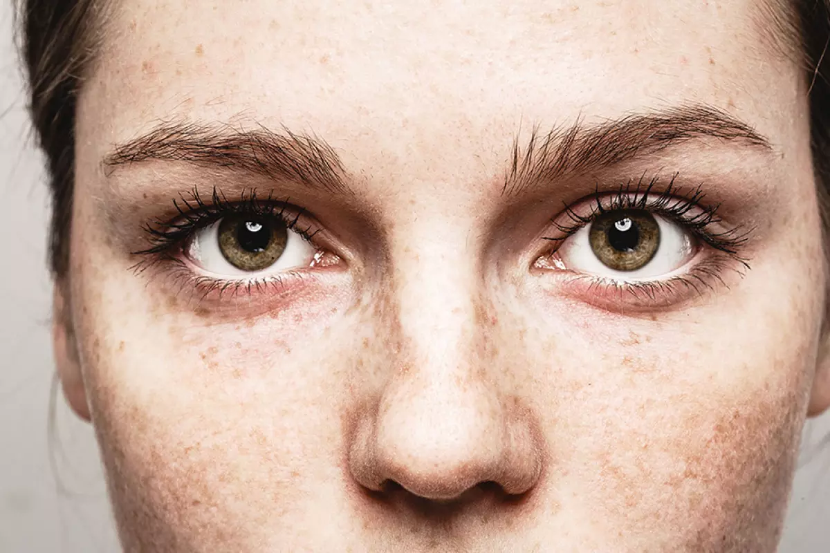 Augen