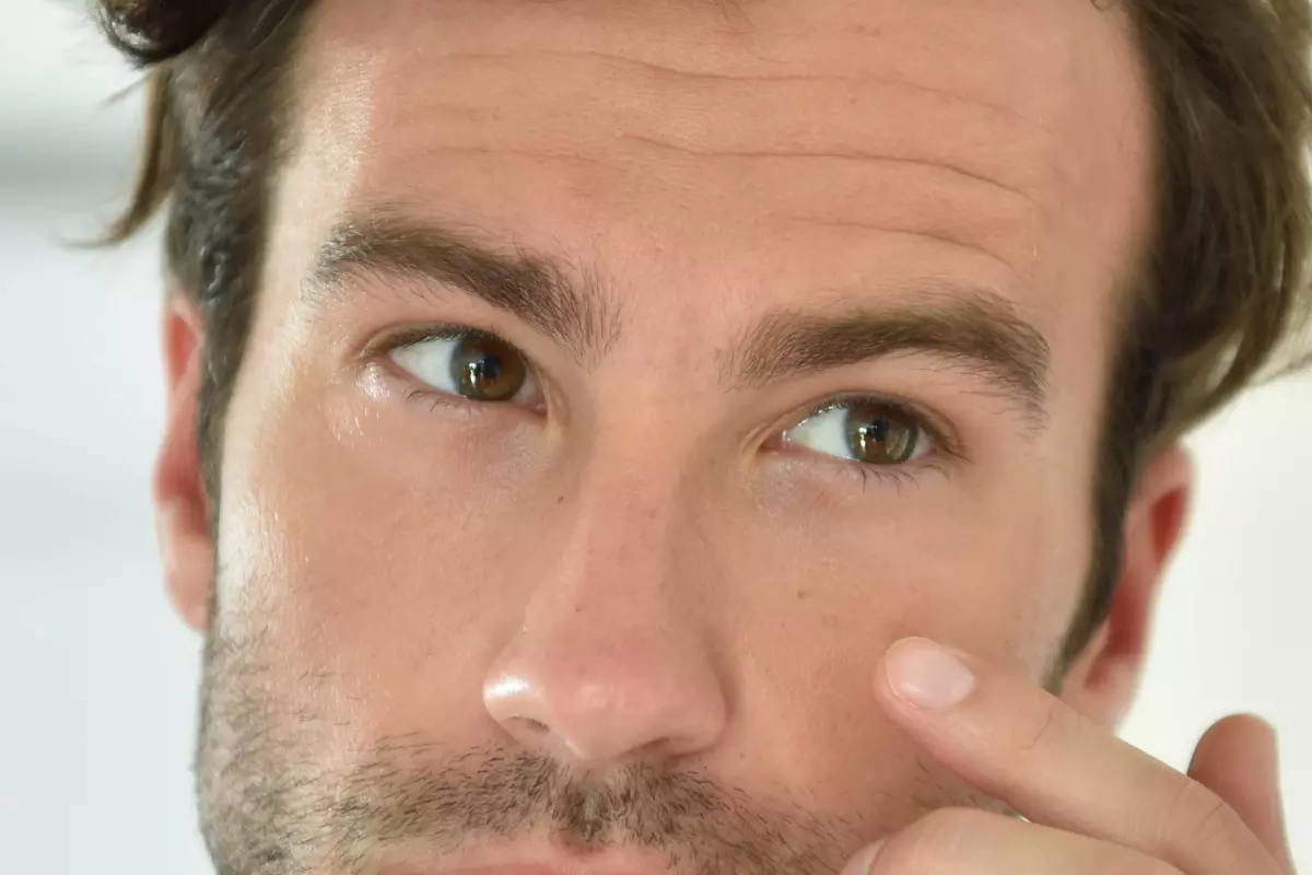 Dark circles men