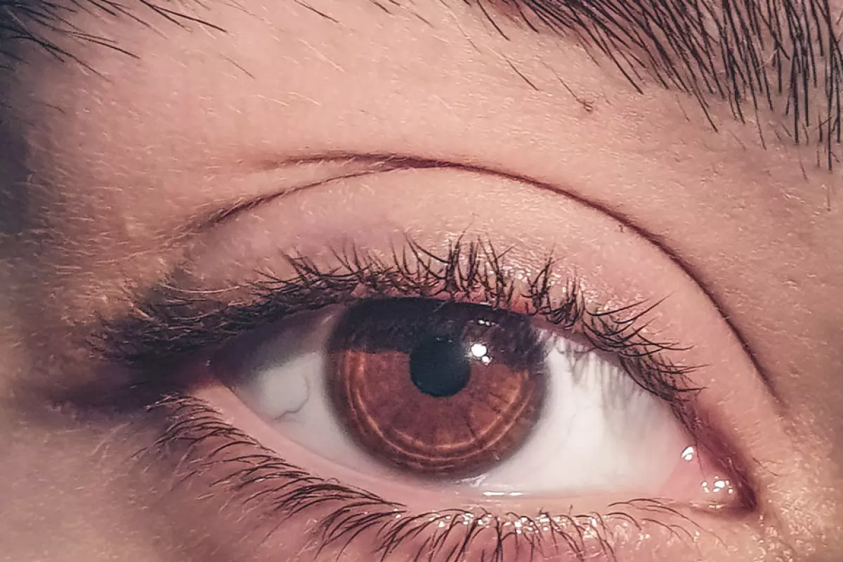 Katzenaugen, «Cat Eye»