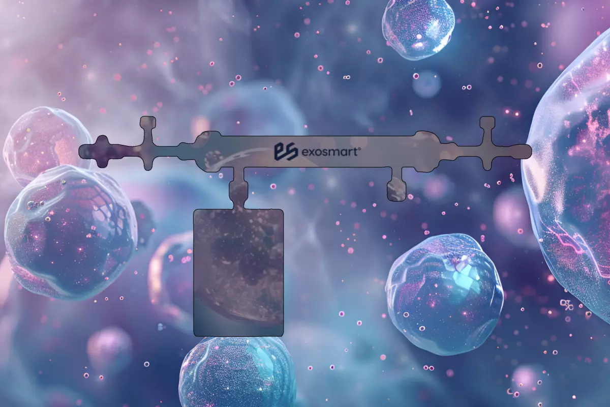 Exosmart<sup>®</sup>