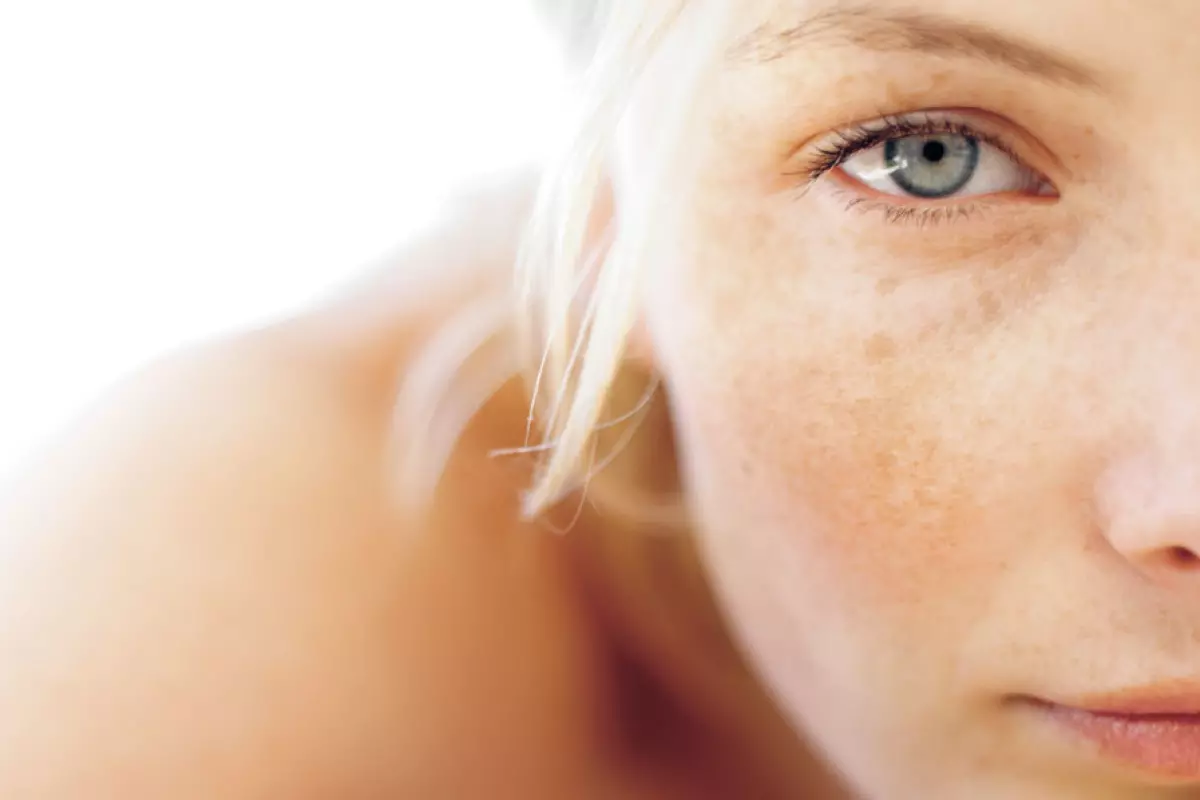 Remove pigment spots